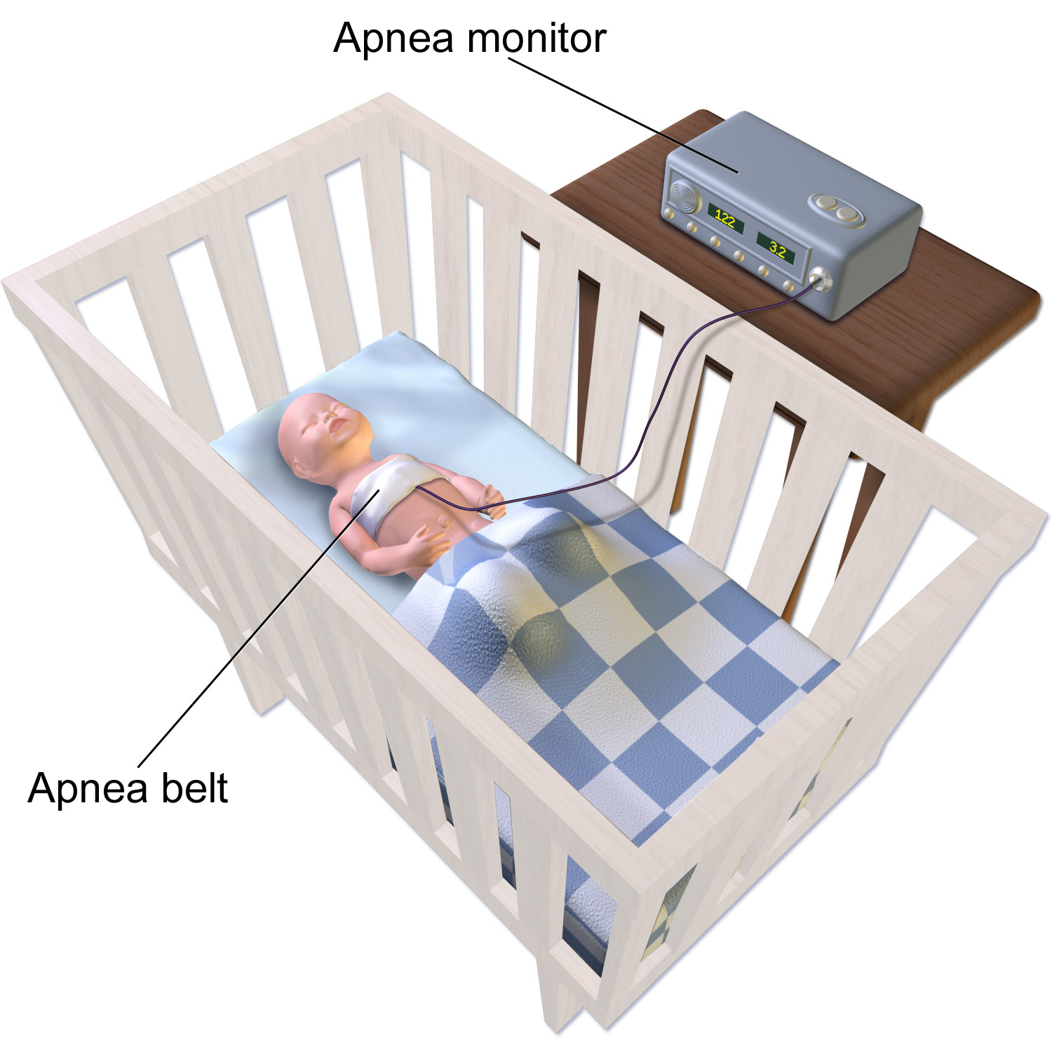 Sleep Apnea | What Are Its Causes And Symptoms?