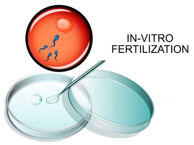 Infertility Treatment Cost In Jaipur