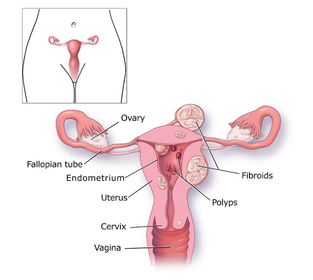 6 Dangerous Causes Of Ovary Pain You Shouldn’t Neglect